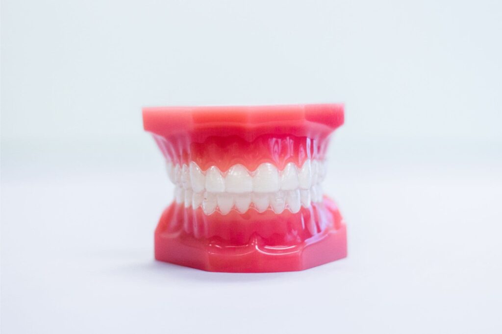 How Can I Prevent Tooth and Gum Issues While Wearing Braces?